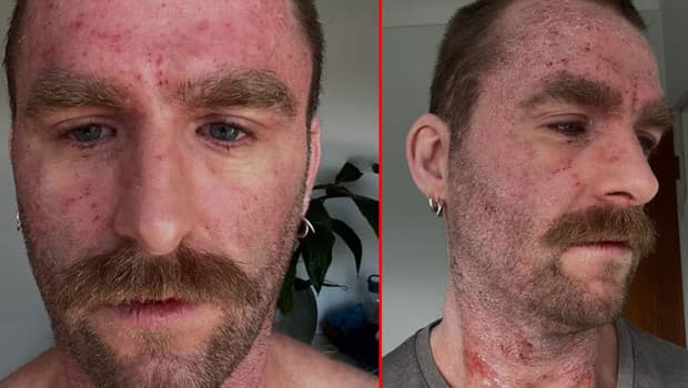 After 30 Years of Suffering, Man Discovers Path to Healing Without Medication
